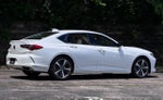 2025 Acura TLX Technology Package